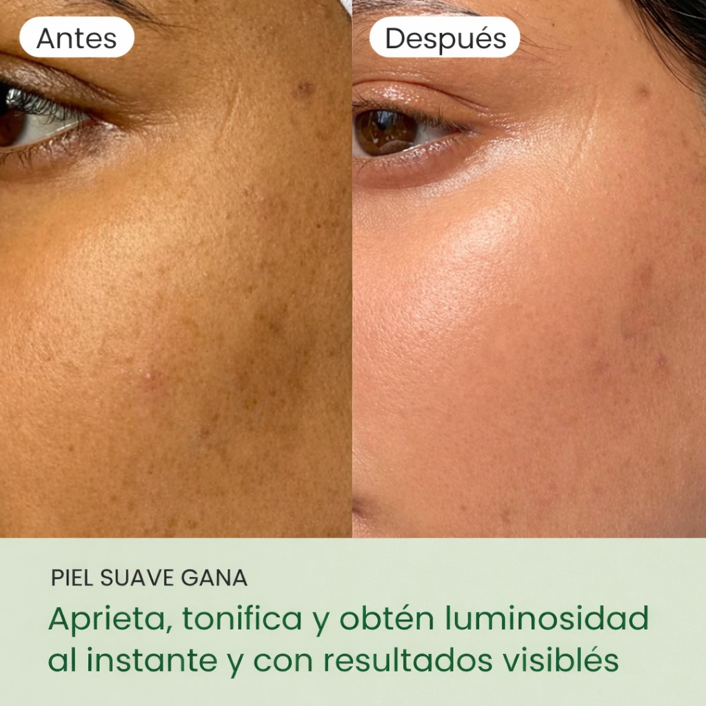 QUIA: No More Pore Pads