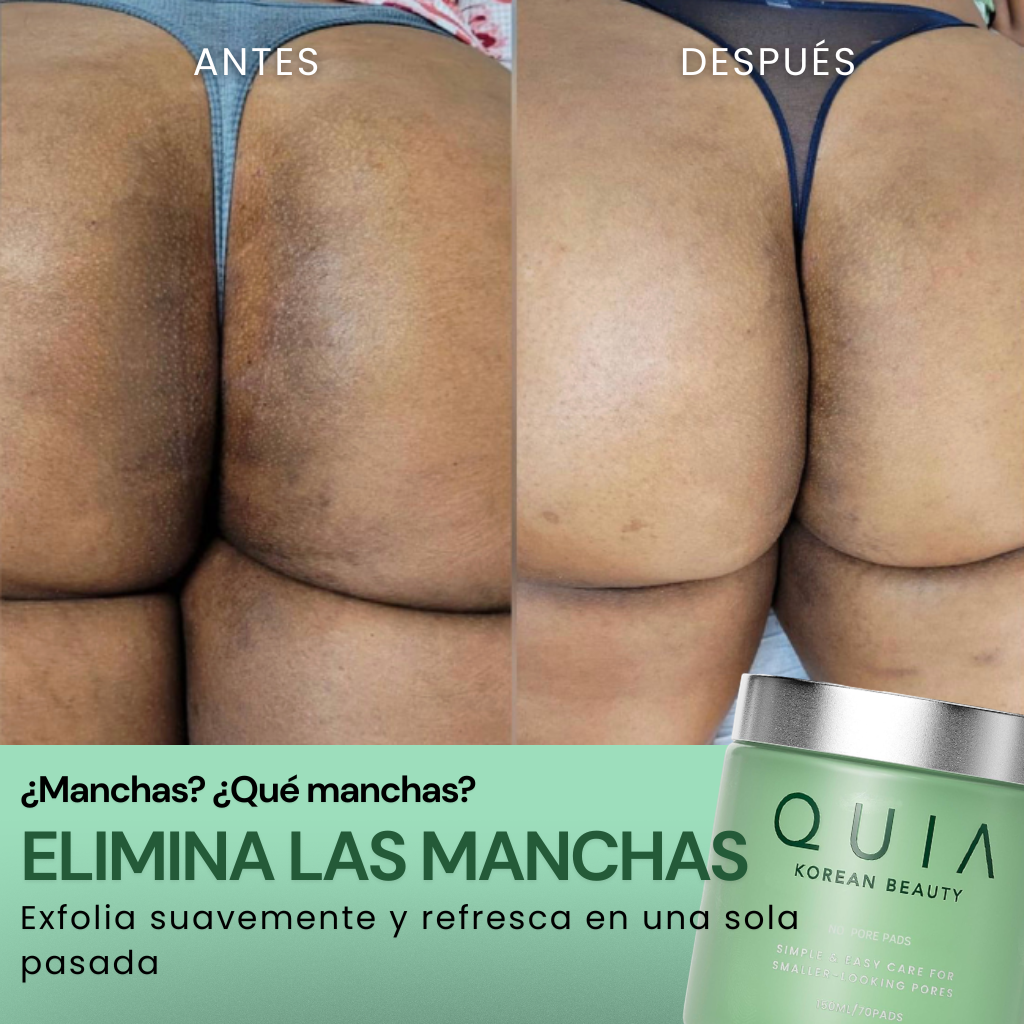 QUIA: No More Pore Pads