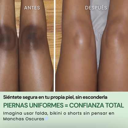 QUIA: No More Pore Pads
