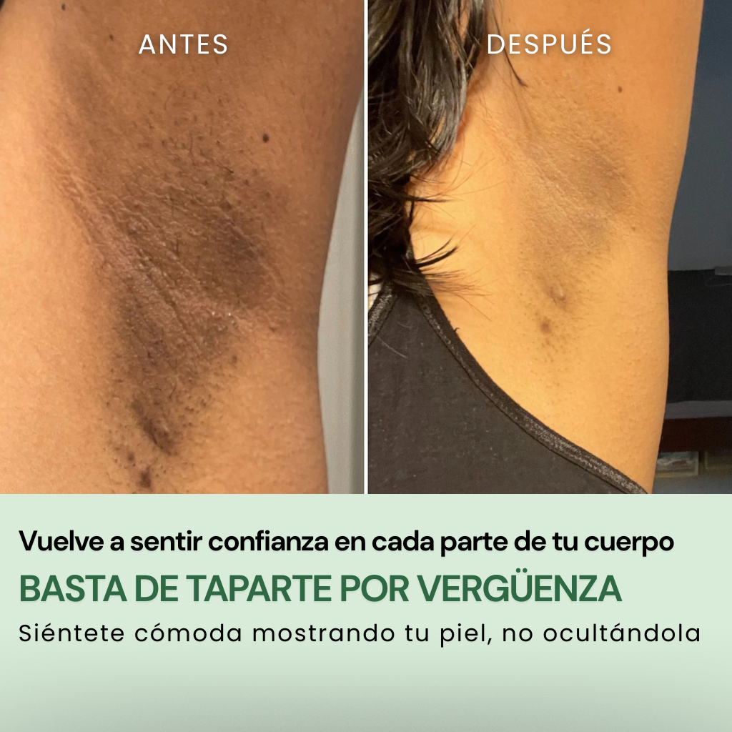QUIA: No More Pore Pads